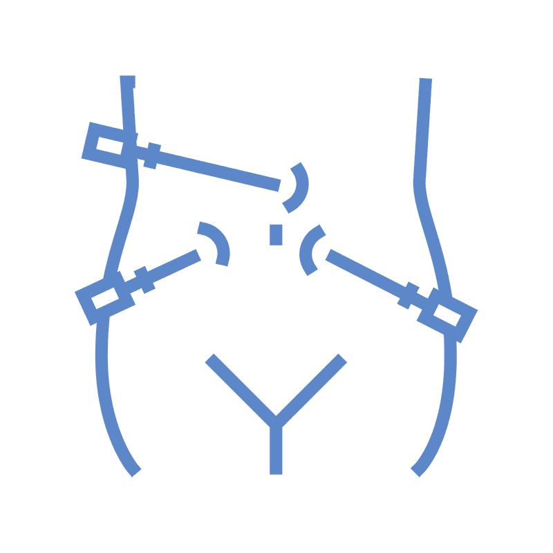 laparoscopia